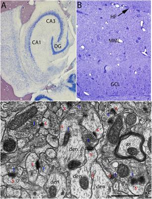 The Curious Anti-Pathology of the Wlds Mutation: Paradoxical Postsynaptic Spine Growth Accompanies Delayed Presynaptic Wallerian Degeneration